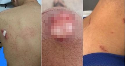 Jovem denuncia ter sido agredido por ao menos 10 seguranças em show de sertanejo