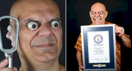 Brasileiro entra para o Guiness com os olhos mais esbugalhados do mundo